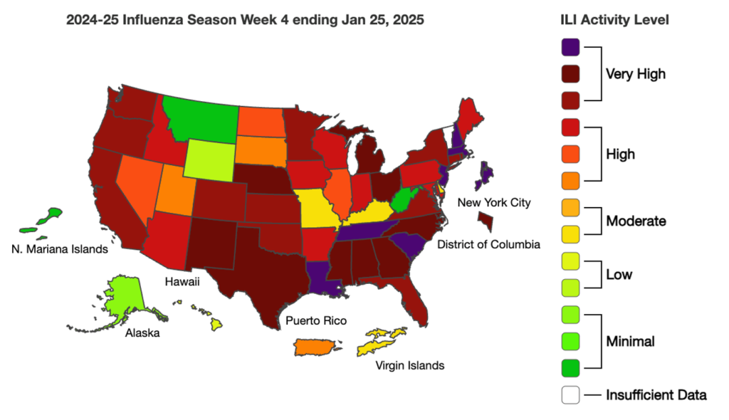 Though Largest in Recorded US History, TB Outbreak Is Considered Low Risk