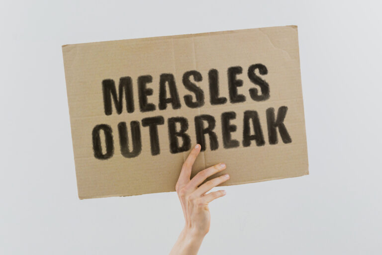 measles